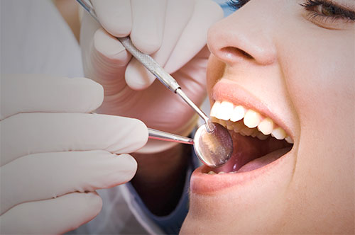 dental_cleanings_exam_1