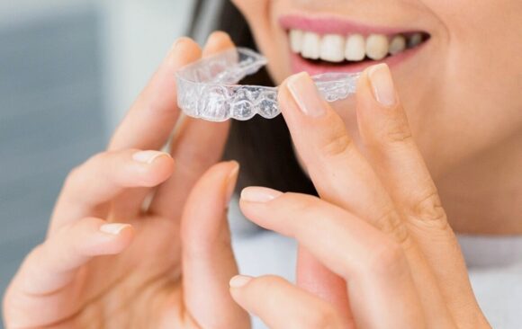 how long does Invisalign take
